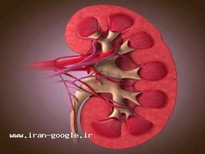 درمان بیماری های کلیوی 