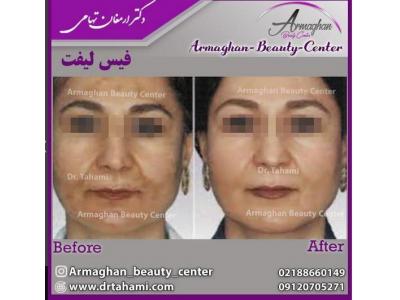 لیپوماتیک ، لیزر ، پیکرتراشی ، تزریق ژل و بوتاکس 