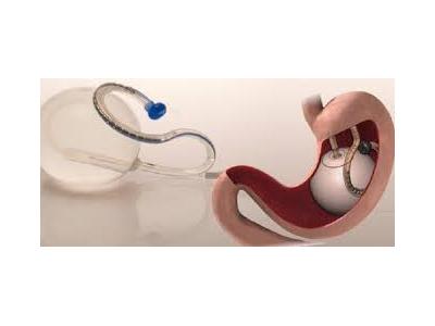 بالون معده  و حلقه معده  توسط فوق تخصص  گوارش 