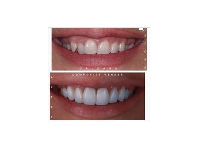 متخصص کاشت ایمپلنت در مشهد 