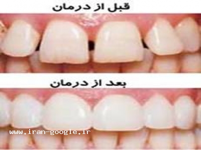 زیبایی دهان و دندان-جراح دهان و دندان 