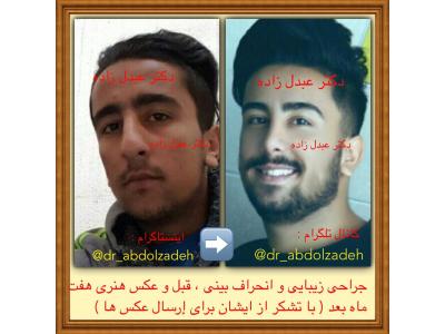 جراحی و زیبایی ترمیمی ، جراحی زیبایی بینی  ،  پیکرتراشی به روش لیزر لیپولیز و لیپوماتیک