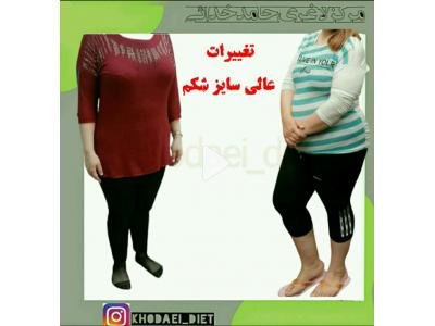 لاغری موضعی تبریز