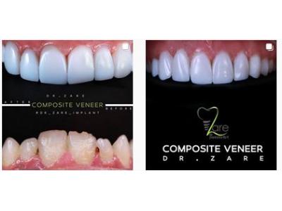 متخصص کاشت ایمپلنت در مشهد 