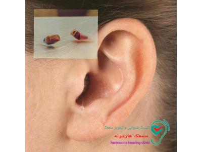 سمعک شمال تهران