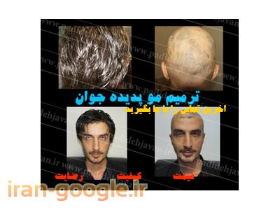 مرکز تخصصی کاشت و ترمیم مو پدیده جوان