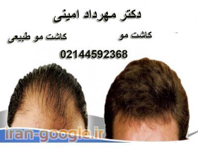  پوست و مو ، کاشت مو ، پاکسازی و لایه برداری صورت