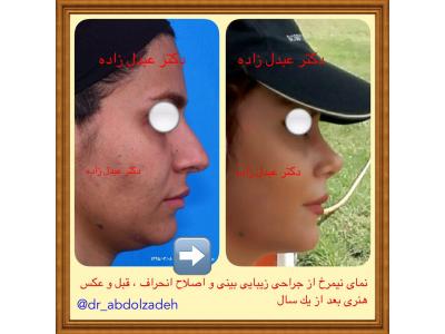 جراحی و زیبایی ترمیمی ، جراحی زیبایی بینی  ،  پیکرتراشی به روش لیزر لیپولیز و لیپوماتیک