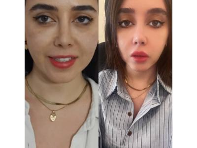 کلینیک پوست و مو رویامیس در شهرک امید و شهرک گلستان