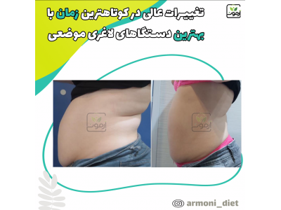 لاغری در تبریز بادستگاه