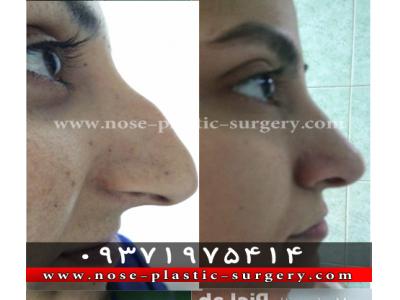 جراحی زیبایی بینی-کلینیک جراحی بینی دکتر علی شهابی