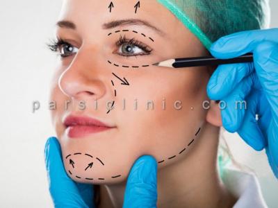 رفع پف چشم-جراحی زیبایی پلک