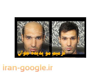مرکز تخصصی کاشت و ترمیم مو پدیده جوان