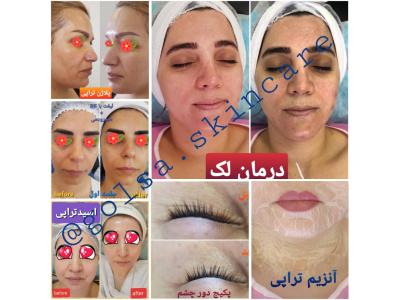 آموزشگاه پوست و زیبایی  در ستارخان (گلسا)