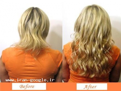 اکستنشن مو با لیزر 