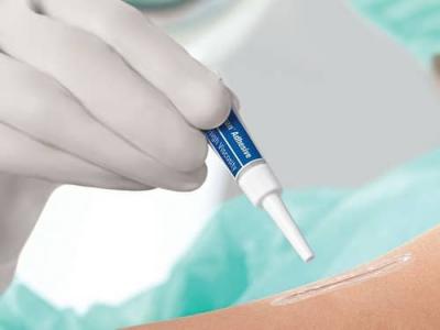 چسب مایع بخیه Epiglu