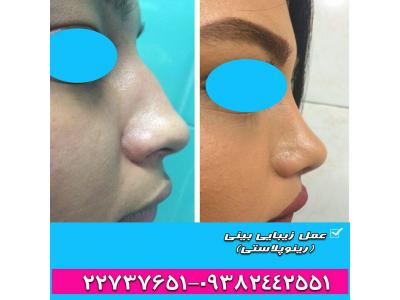 جراحی زیبایی صورت و بینی-مرکز مشاوره تخصصی عمل زیبایی بینی در تهران