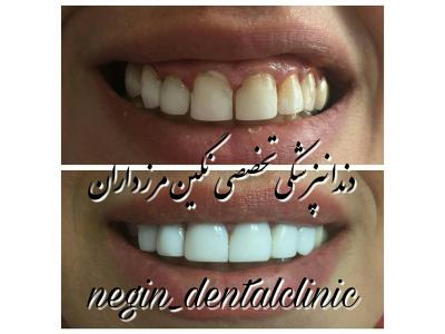 دندانپزشکی تخصصی  در مرزداران ،  دندانپزشکی تخصصی نگین مرزداران