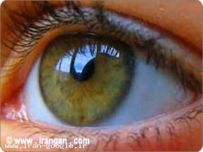 متخصص چشم-چشم پزشکی قرنیه 