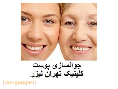 ارائه خدمات بوتاکس صورت در تهران-تهران لیزر کلینیک  تخصصی لیزر موهای زائد ، جوانسازی و لایه برداری پوست 