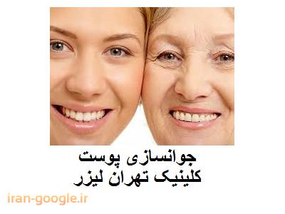 تهران لیزر کلینیک  تخصصی لیزر موهای زائد ، جوانسازی و لایه برداری پوست 