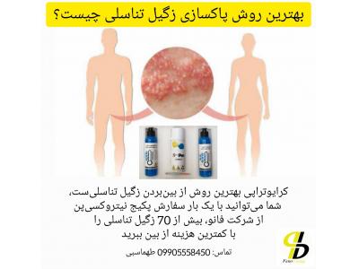 زگیل تناسلی چیست و چگونه کرایوتراپی کنیم؟ 