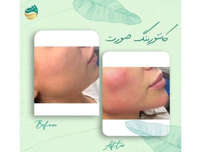 کلینیک  زیبایی دکتر فتوحی