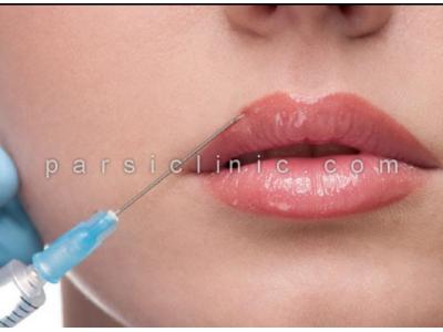 لیپوساکشن-جراحی زیبایی پلک