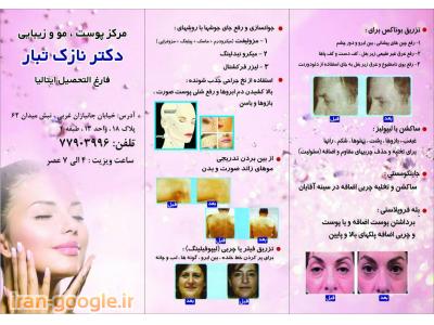 برای از بین بردن خط خنده-متخصص پوست و مو در شرق تهران ، لیزر موهای زائد صور ت و بدن 
