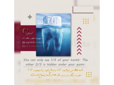 طراحی گرافیک، موشن گرافیک، انیمیشن، تیزر