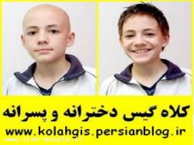 کلاه گیس زنانه و کلاه گیس مردانه طبیعی