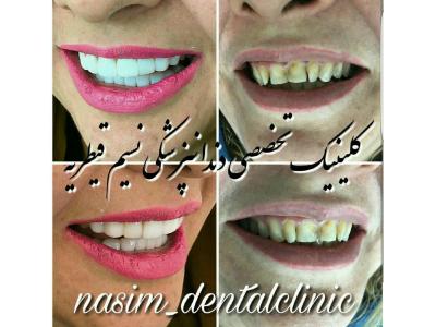 دندانپزشکی در منطقه یک تهران ،  کلینیک دندانپزشکی نسیم قیطریه