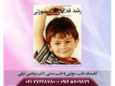 طب سوزنی در شرق تهران