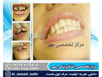 بهترین دندانپزشکی در شمال تهران