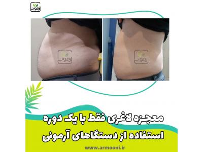 لاغری در تبریز بادستگاه