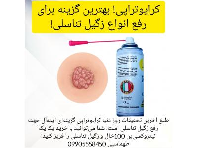 اسپری کرایوتراپی نیتروکسی ایتالیا، درمان زگیل تناسلی