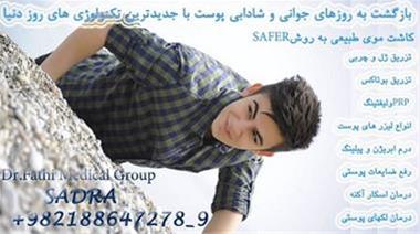 کاشت موی طبیعی تزریق ژل رفع چین و چروک موهای زائد