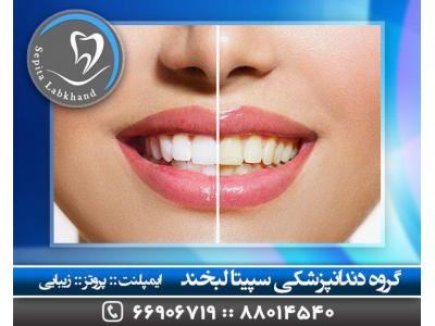 جراح و دندانپزشک زیبایی-جراح لثه در تهران