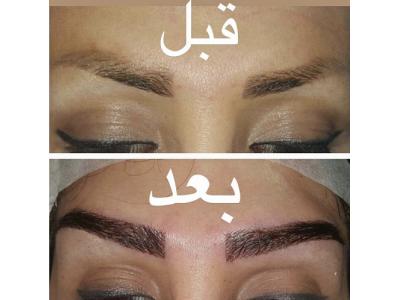 کاشت ابرو بصورت کاملا تخصصی