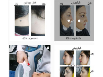 کلینیک زیبایی و لیزر دکتر مجتبی عقیلی در کردکوی
