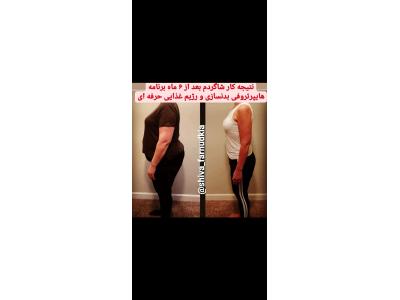 لاغری تضمینی در تبریز