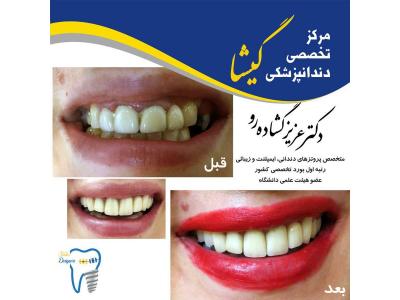 مركز تخصصي دندانپزشكي گيشا