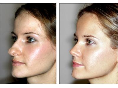 جراحی ایمپلنت و زیبایی-زیبایی فک  و صورت