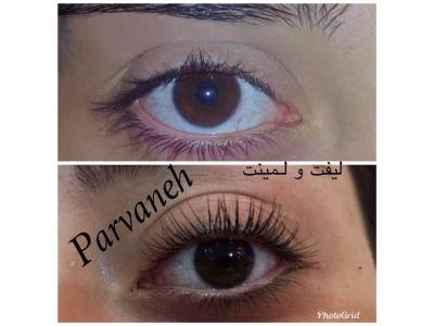 میکروبلیدینگ فیبروز ،حجیم سازی لب ، بن مژه 