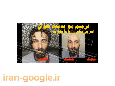مرکز تخصصی کاشت و ترمیم مو پدیده جوان