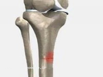  خوش اندام شوید