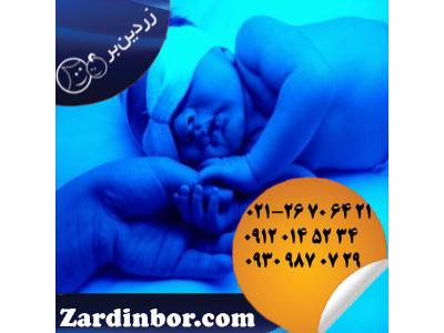 اجاره دستگاه زردی نوزاد با شرکت زردین بر