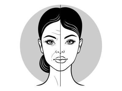 بوتاکس در شیراز