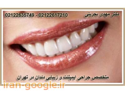 متخصص ایمپلنت تهران-کلینیک تخصصی دندانپزشکی آرمان در شریعتی