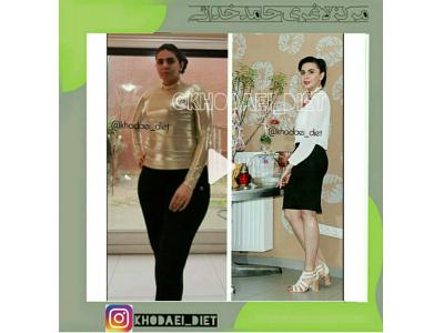 لاغری موضعی تبریز